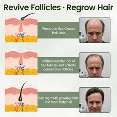 Follicure BioGrow Hair Restoration Spray 50 ml (Pack of 2)