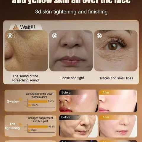 Anti-Wrinkle Forehead (Pack of 2) 100ml Each